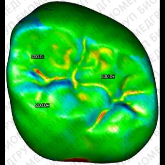 Программное обеспечение для стоматологии ORIGIN Inspection