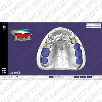 Exocad Partial Framework Module  модуль для создания бюгелей