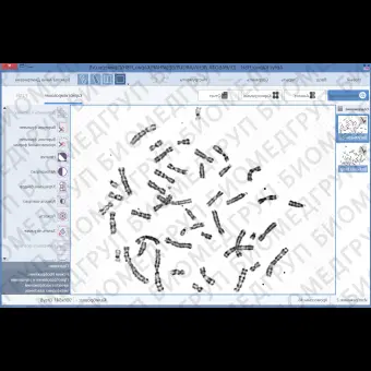 ПО для автоматического анализа хромосом, кариотипирования, АргусKaryo, АргусСофт, ARGUS  KARYO