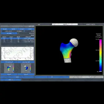 Программное обеспечение для остеоденситометрии 3DDXA