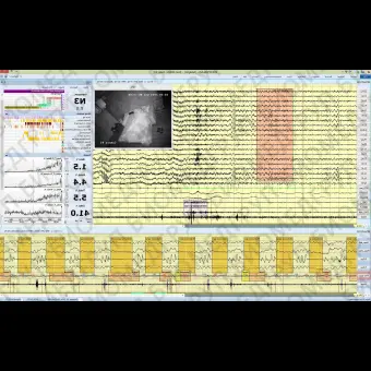 Полисомнограф с EEG