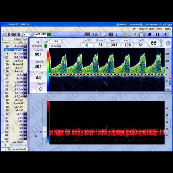 Трансчерепной доплер DigiLite