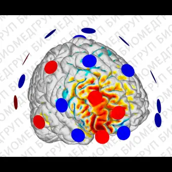 Электрический транскраниальный стимулятор tDCS STARSTIM R32