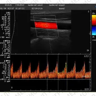 Ультразвуковой сканер на платформе C200