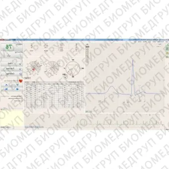 Электрокардиограф для спокойного состояния BTL CardioPointECG C600