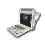 Переносной ультразвуковой сканер XF3600